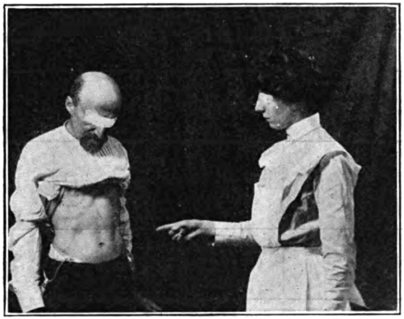 Illustrative figure from Albert Abrams' 'Human Energy': Fig. 13 -- Illustrating the method of eliciting the stomach reflex by directing the extended fingers in the direction of the epigastrium.