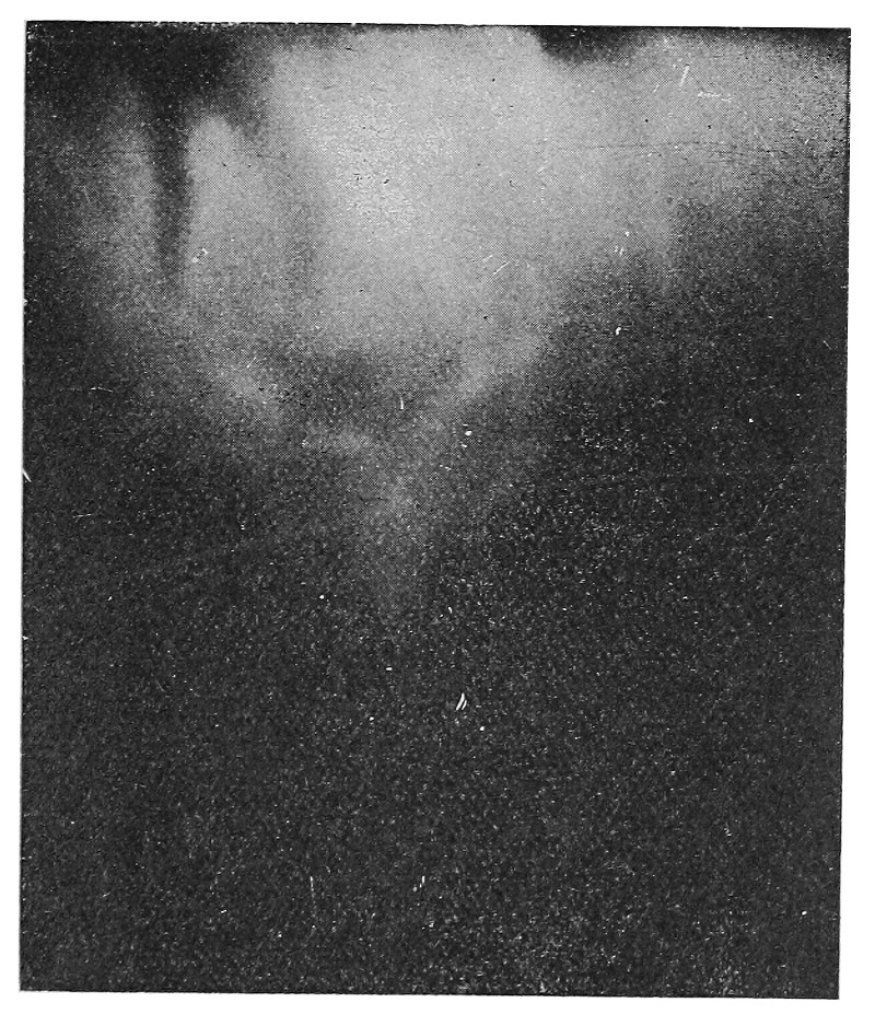 2nd Psychicone, image of Dr. Baraduc, a projection by Mme B., under the same conditions.