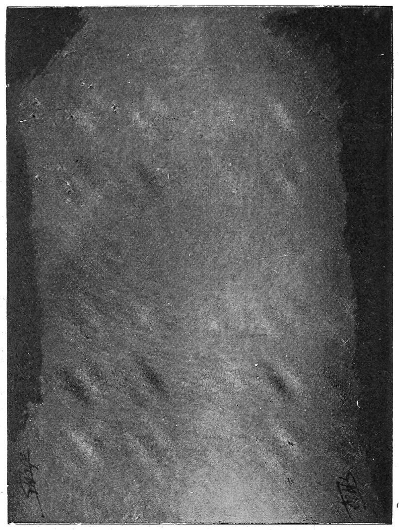 This iconography of the light life of the Word was obtained July 1895, in the dark with red light, by the electro-negative method, called by appeal by N.P. & Dr. Baraduc, their three hands joined in front of the plate without photographic instrument.